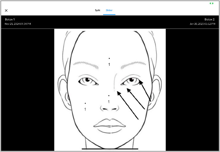 Slider_view_-_Global_Gallery.png