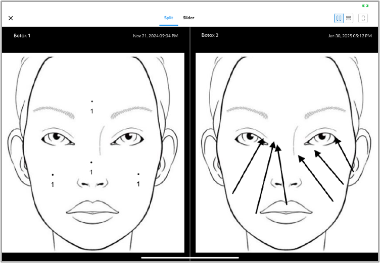 Split_view_-_Global_Gallery.png